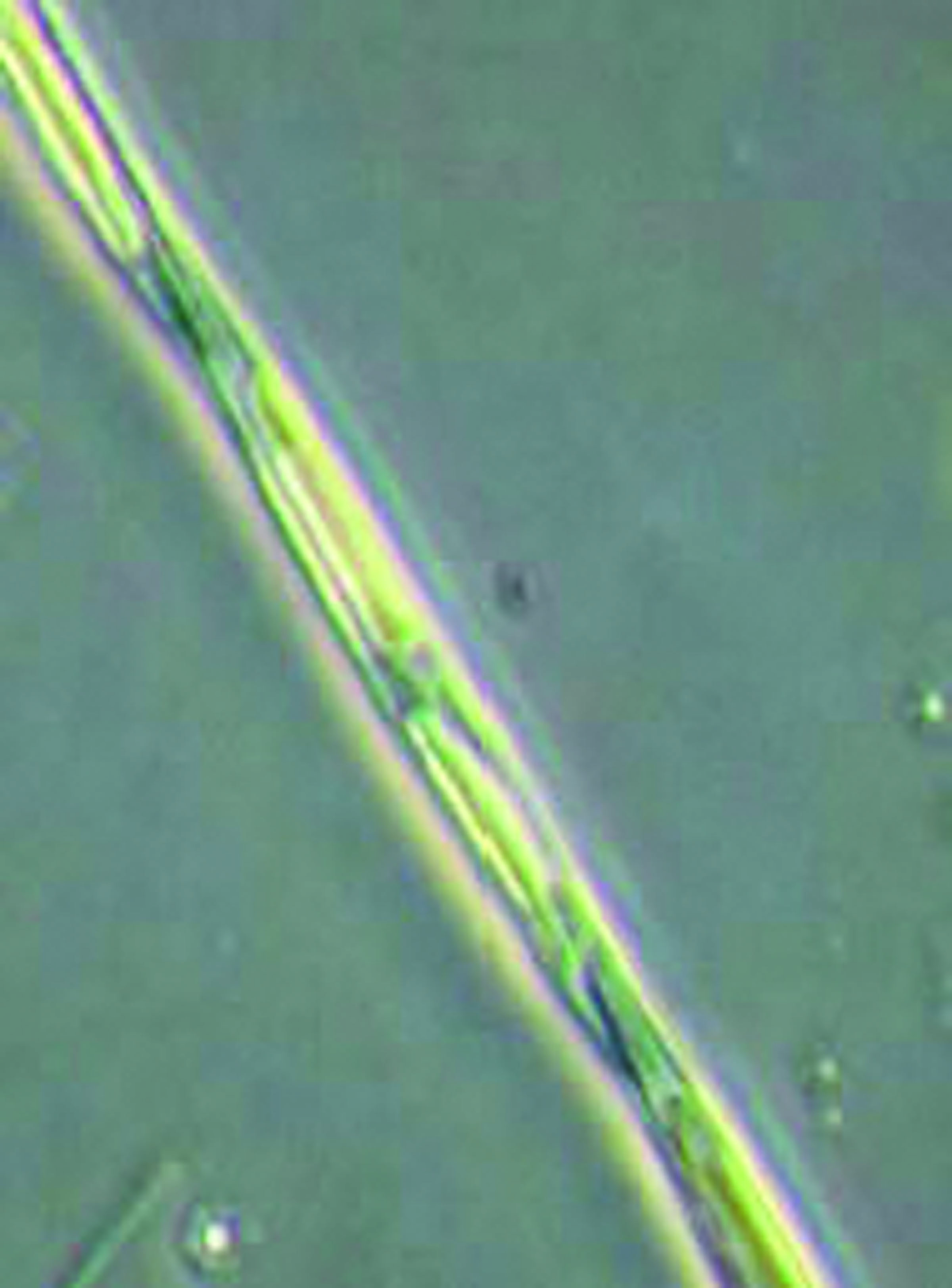 The marine algae Pseudo-nitzschia can at times create domoic acid. Washington Department of Fish and Wildlife