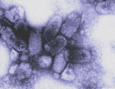 The rabies virus