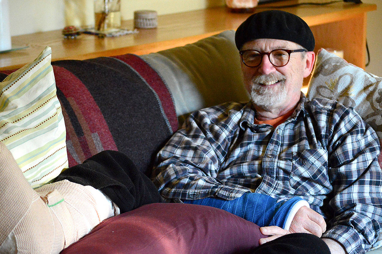 Cyclist Dave Thielk, struck by a tree on Olympic Hot Springs Road last month, is on the mend at home in Port Townsend. Diane Urbani de la Paz/Peninsula Daily News